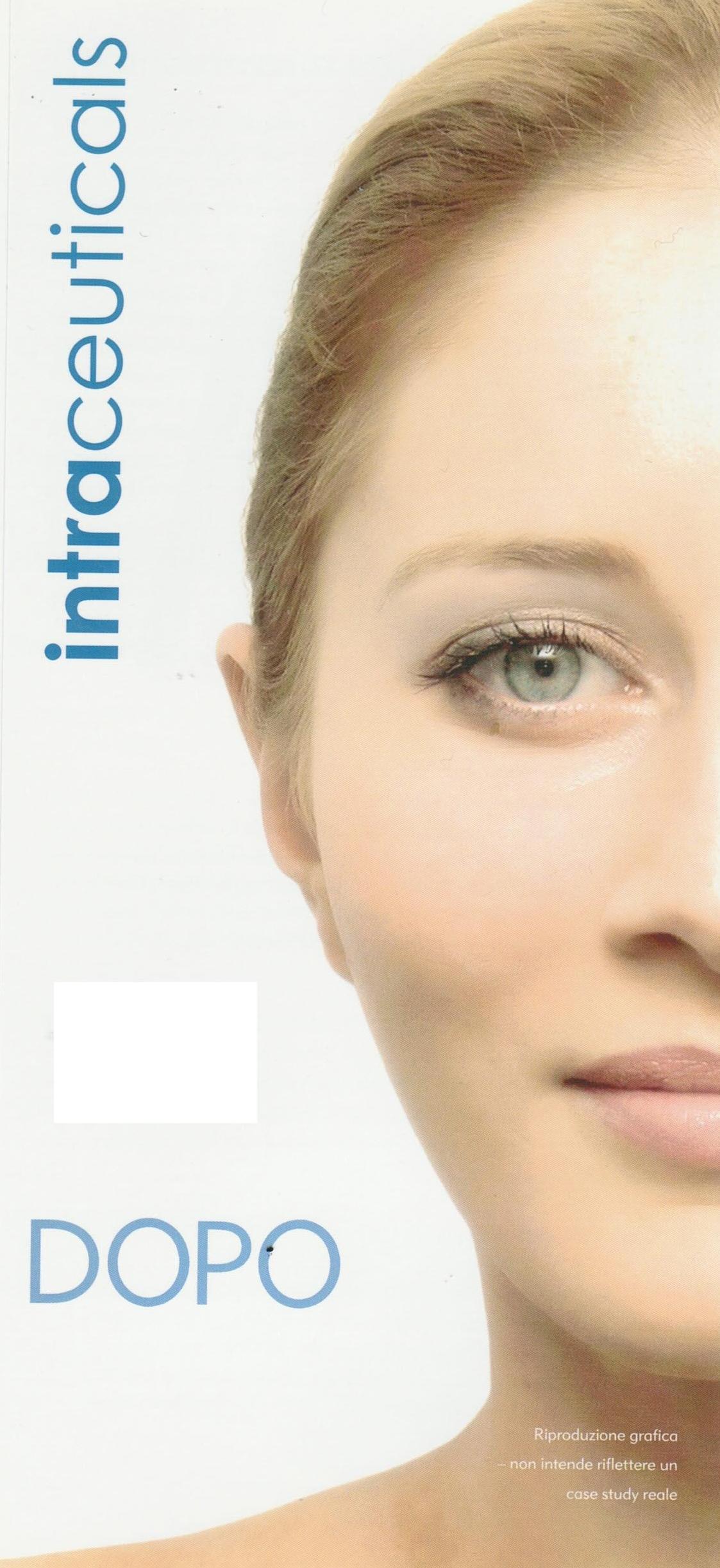 intraceuticals roma
