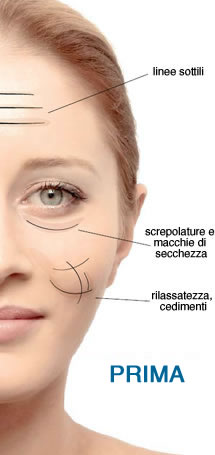intraceuticals roma
